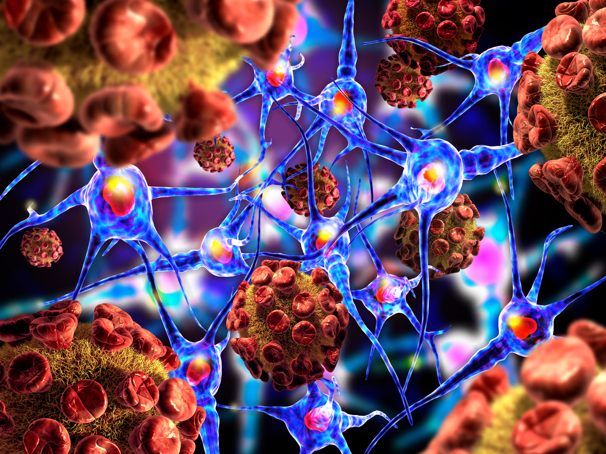 Highlights from ACTRIMS Forum 2021