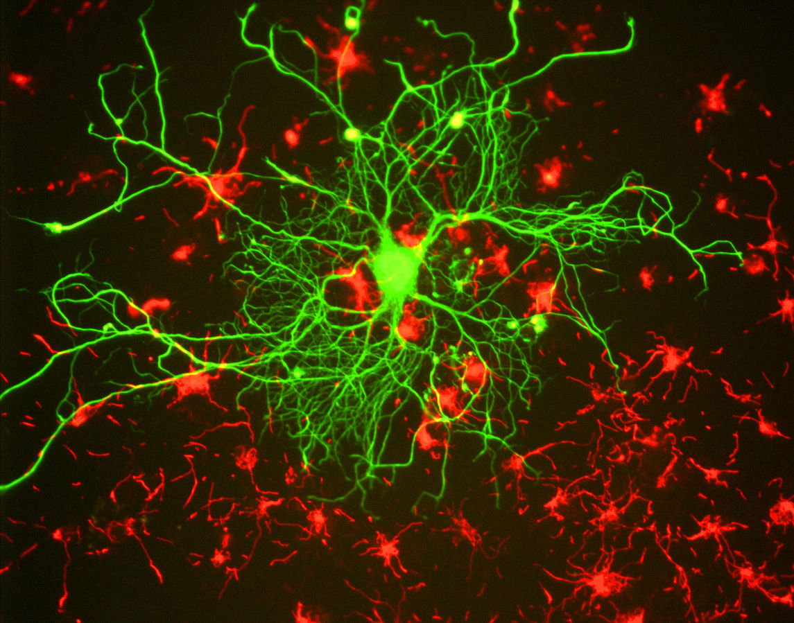 The present and future of biomarkers in MS