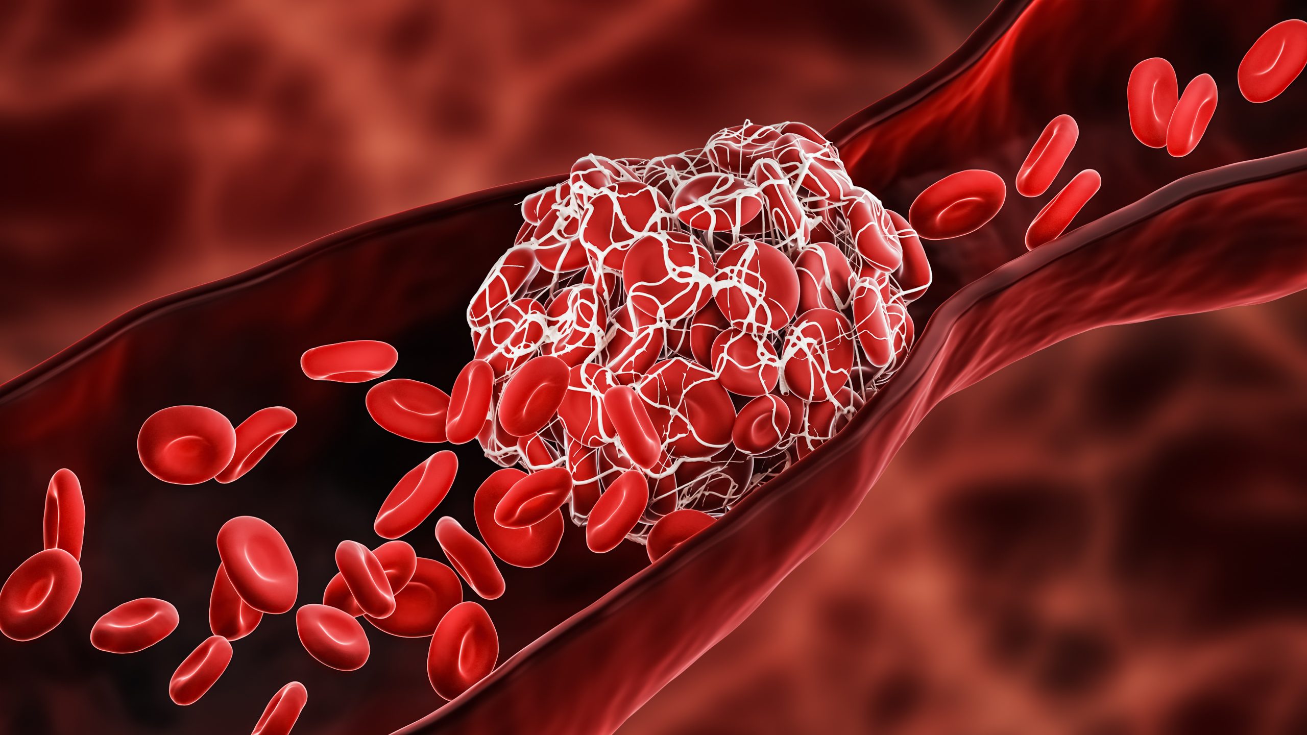 New stroke guidelines:  MSUs for prehospital stroke management and IVT before MT in patients with acute ischemic stroke